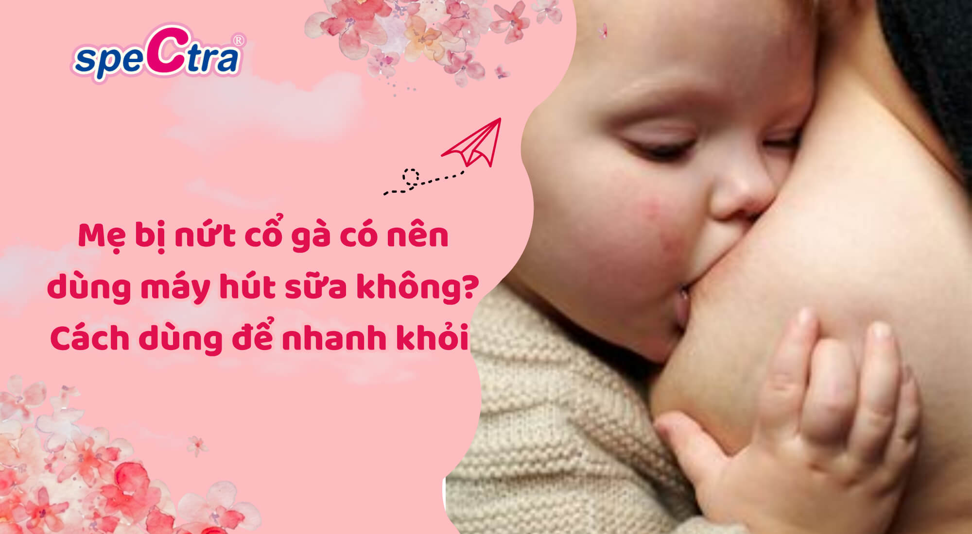 Mẹ bị nứt cổ gà có nên dùng máy hút sữa không? Cách dùng để nhanh khỏi 2026