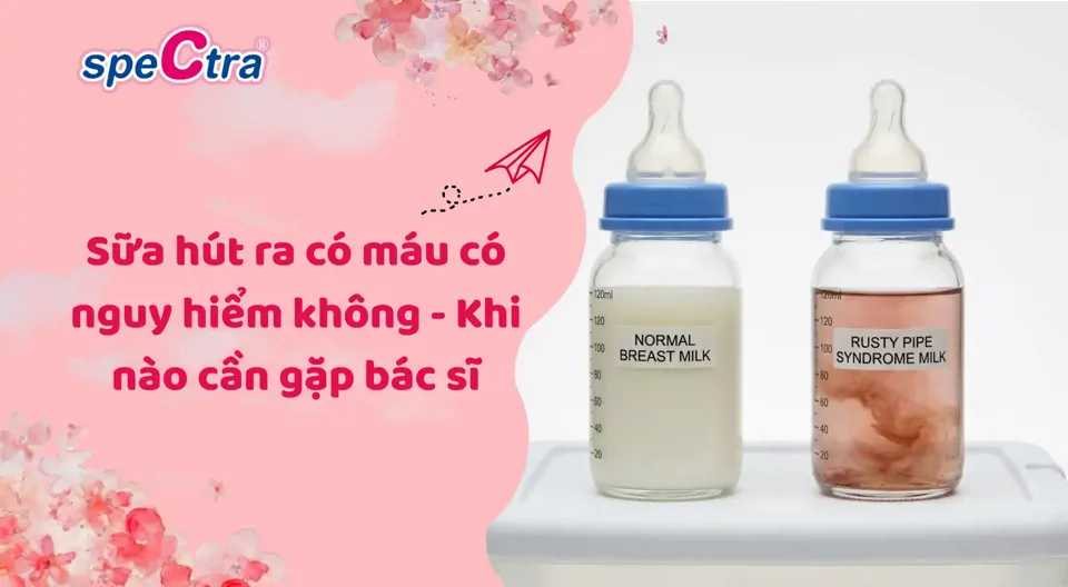 Sữa hút ra có máu có nguy hiểm không? Lời khuyên bác sĩ