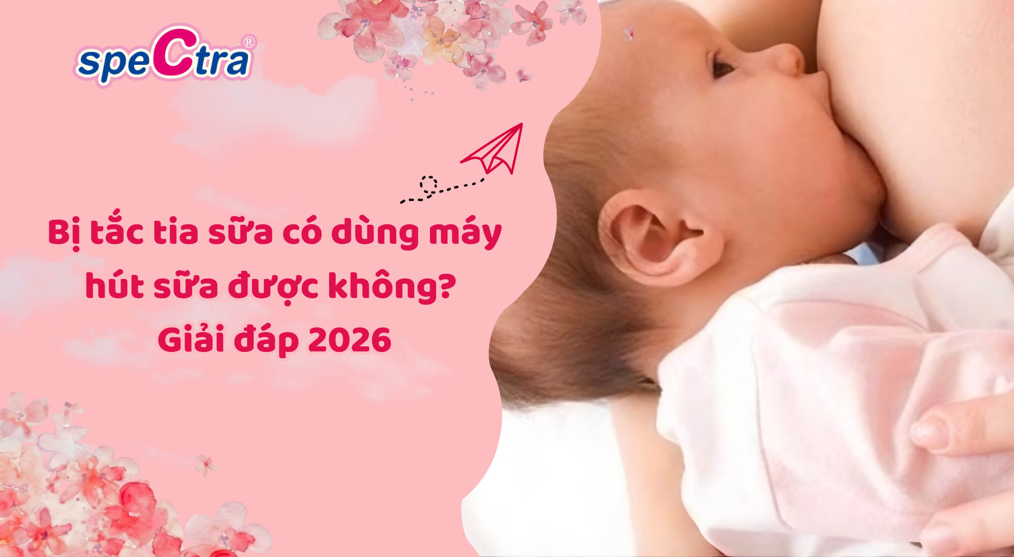 Bị tắc tia sữa có dùng máy hút sữa được không? Giải đáp 2026